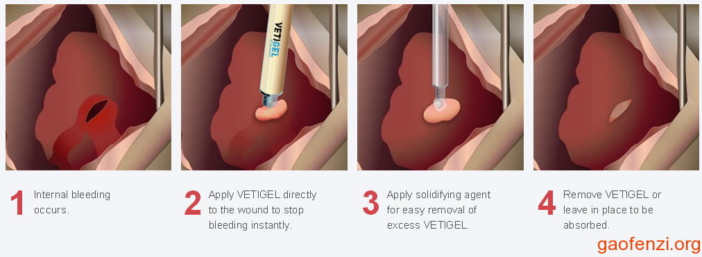 止血凝胶vetigel