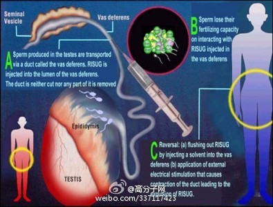 Vasalge避孕凝胶材料