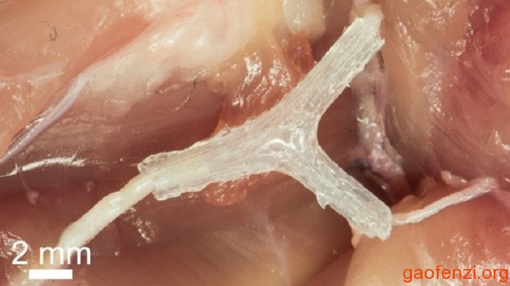 3D打印硅胶导管修复神经再生