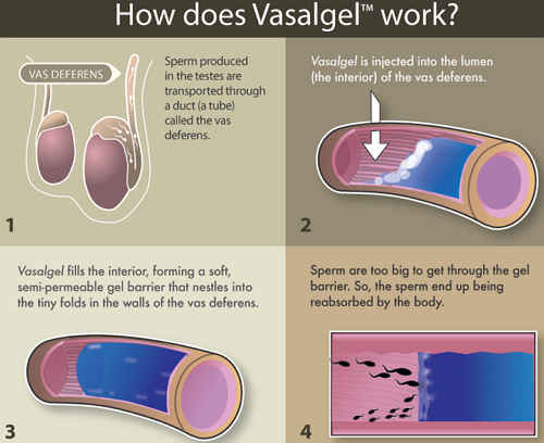 Vasalgel